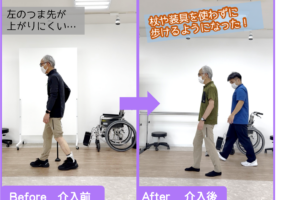 「また登山に行きたい!」その夢に近づいたリハビリ