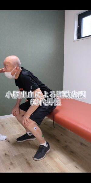 運動失調のリハビリ#shorts