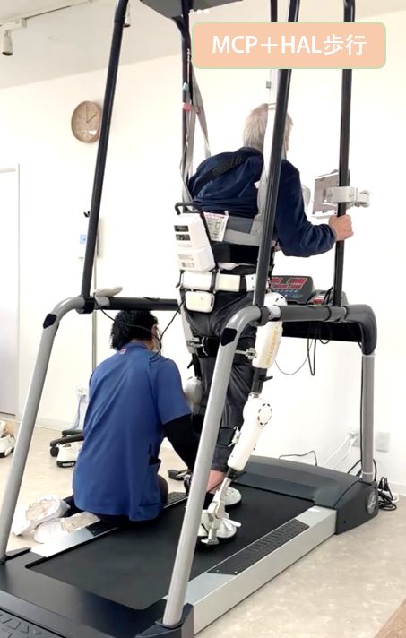 リハビリ中の画像