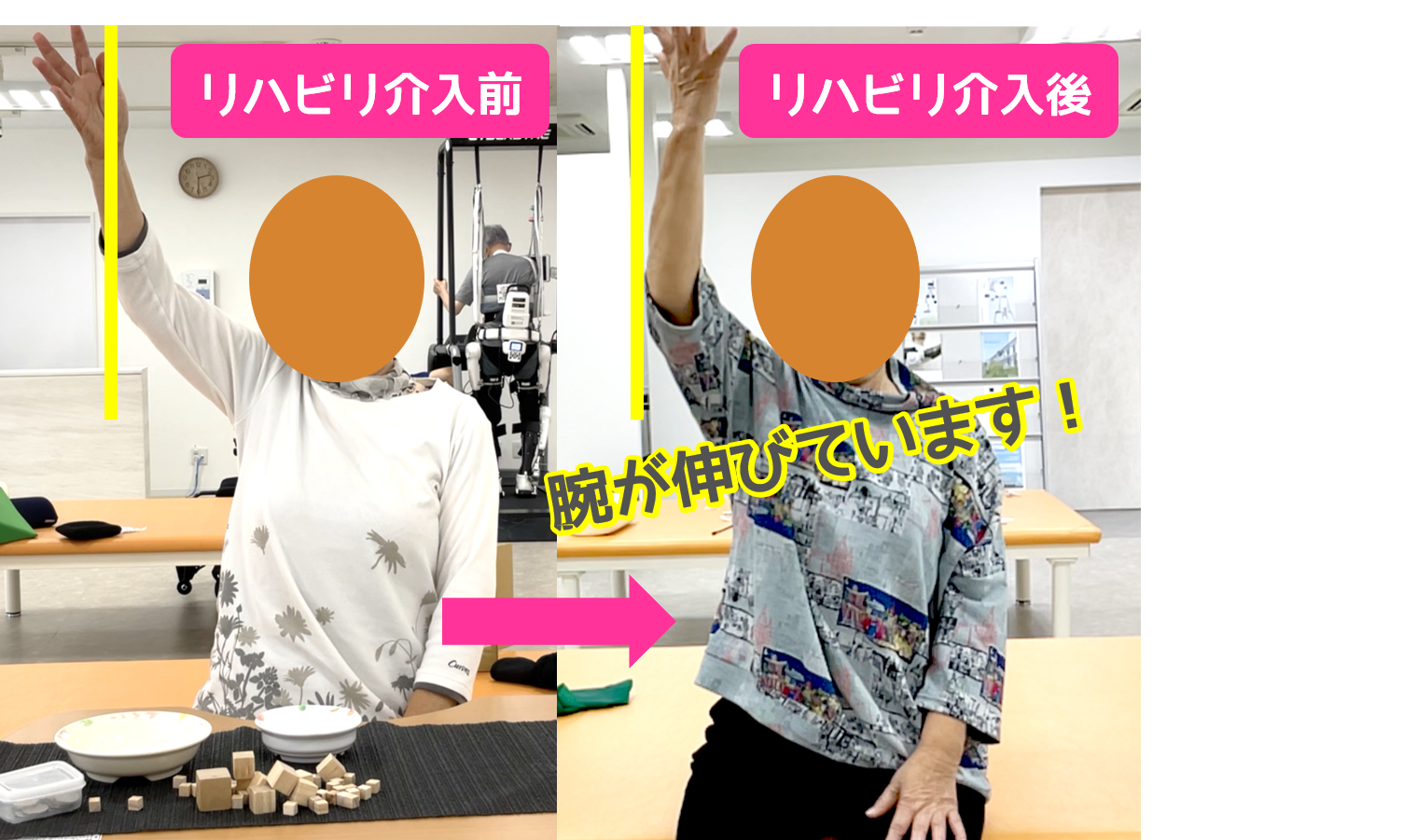 リハビリ中の画像