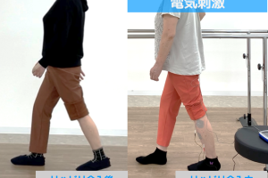 反張膝を治して、装具を外したい!