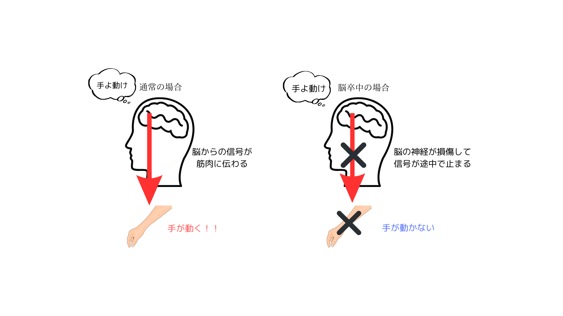 脳から筋肉への信号の図