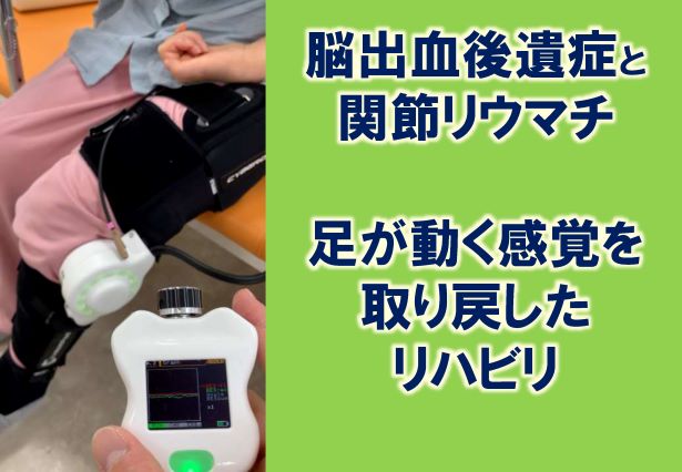 足が動く感覚を取り戻した リハビリ
