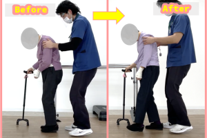 歩行時の姿勢が良くなり、つまずきも減少