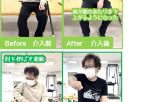 リハビリを続けて、肩や肘の動きが広がった