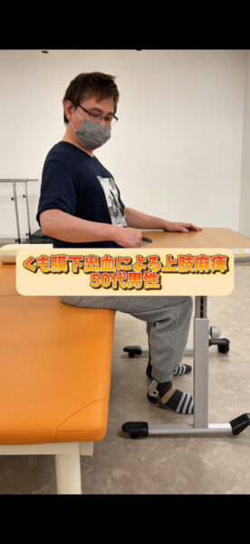 手の麻痺リハビリ#shorts