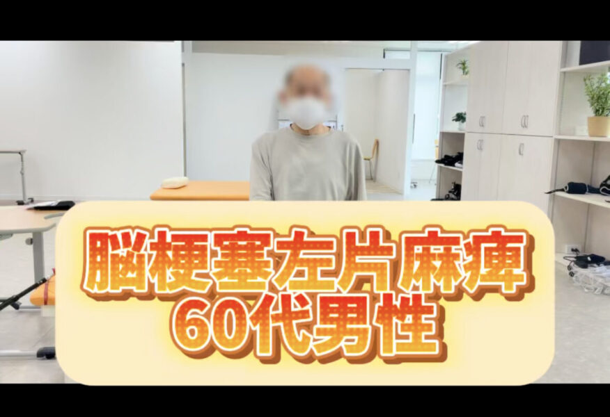 手の麻痺リハビリ#shorts