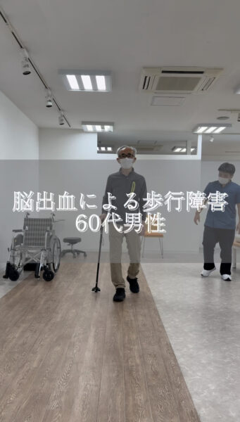 脳出血による歩行障害　60代男性#shorts