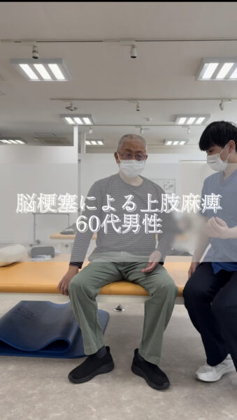脳梗塞による上肢麻痺　60代男性#shorts