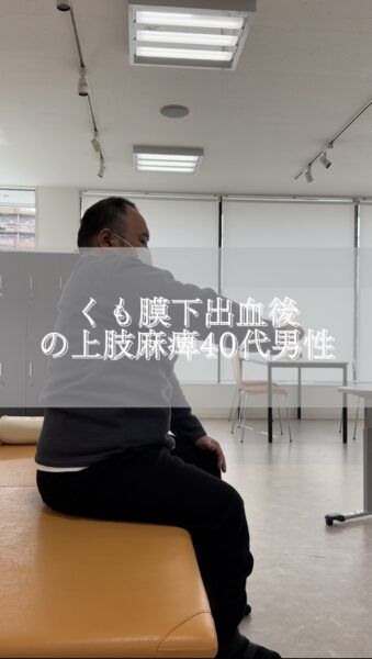 くも膜下出血後の上肢麻痺#shorts