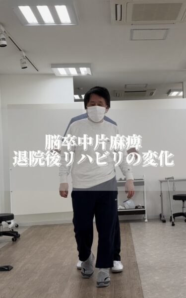 脳卒中退院後のリハビリの変化