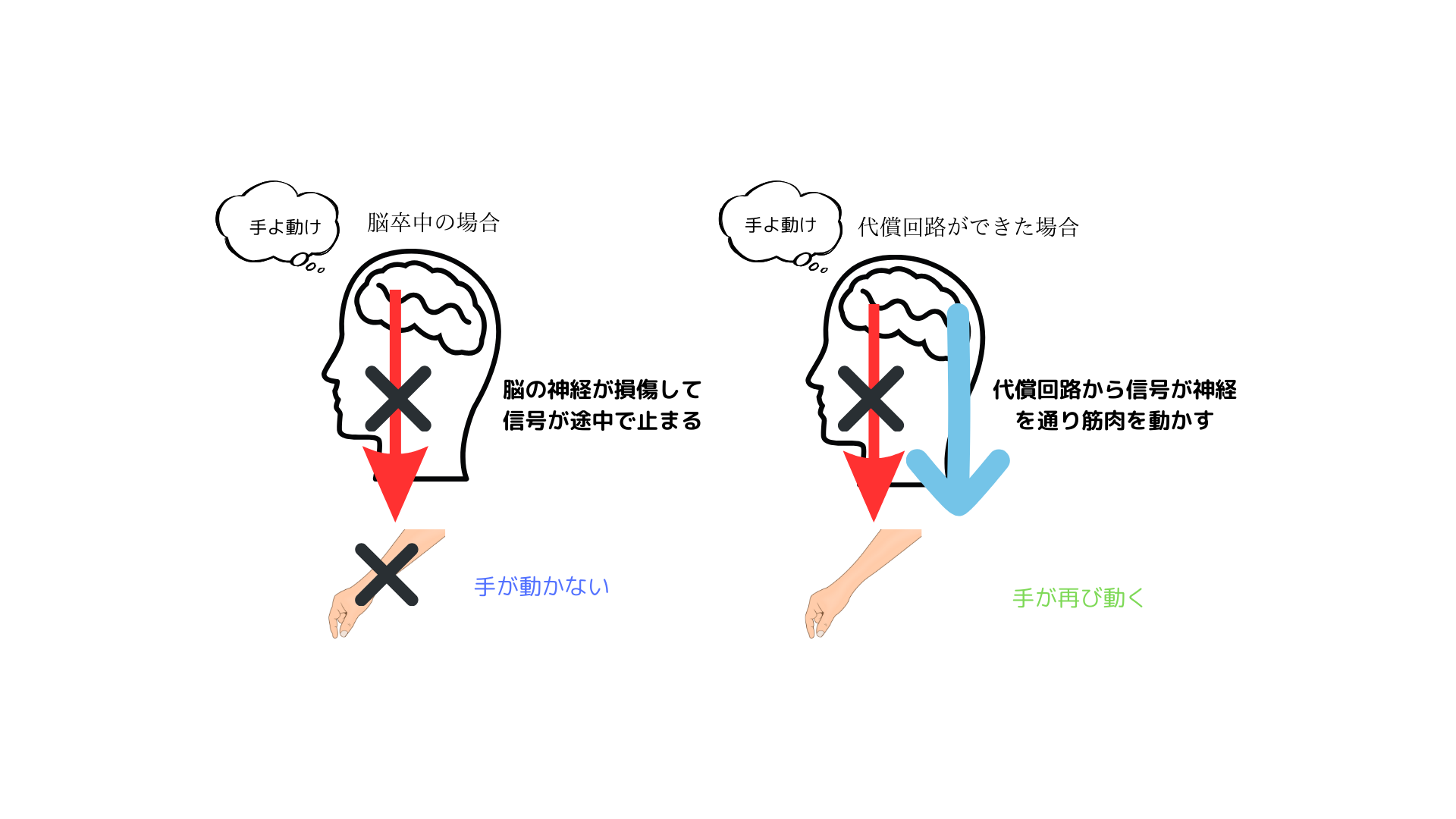 代償回路の図