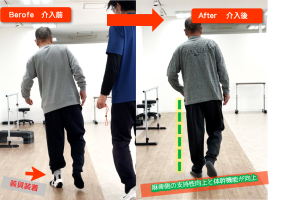 杖・装具なしでも足を擦らずに歩行