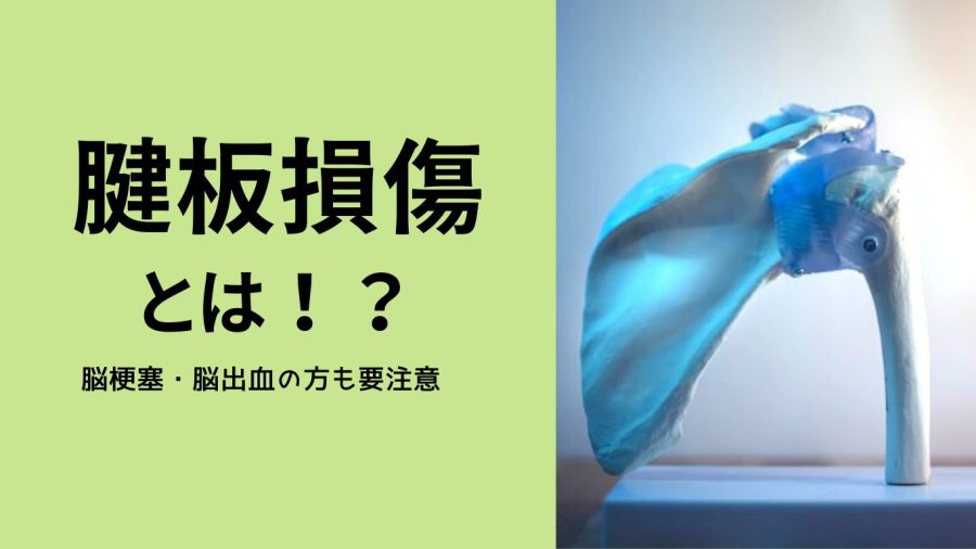 見過ごせない肩の痛み！！腱板損傷とは？