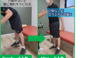 介助なしでの立ち上がりが実現