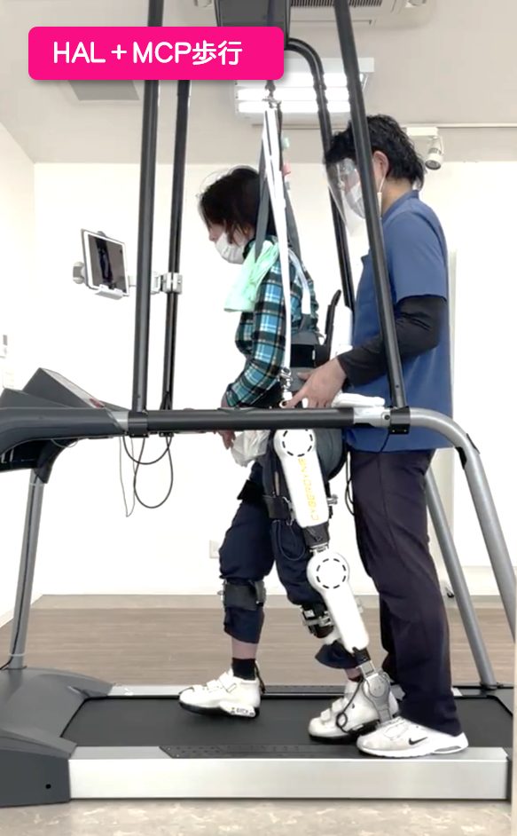 リハビリ中の画像